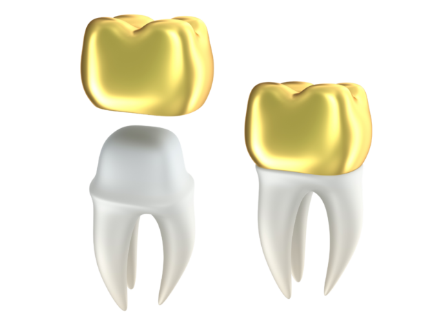 Cosmetic Dentistry Dental Crown